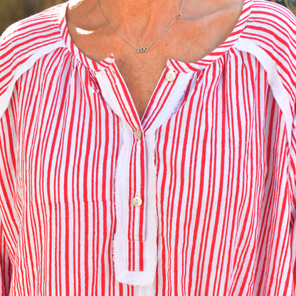 cotton voile block print stripe dress 164